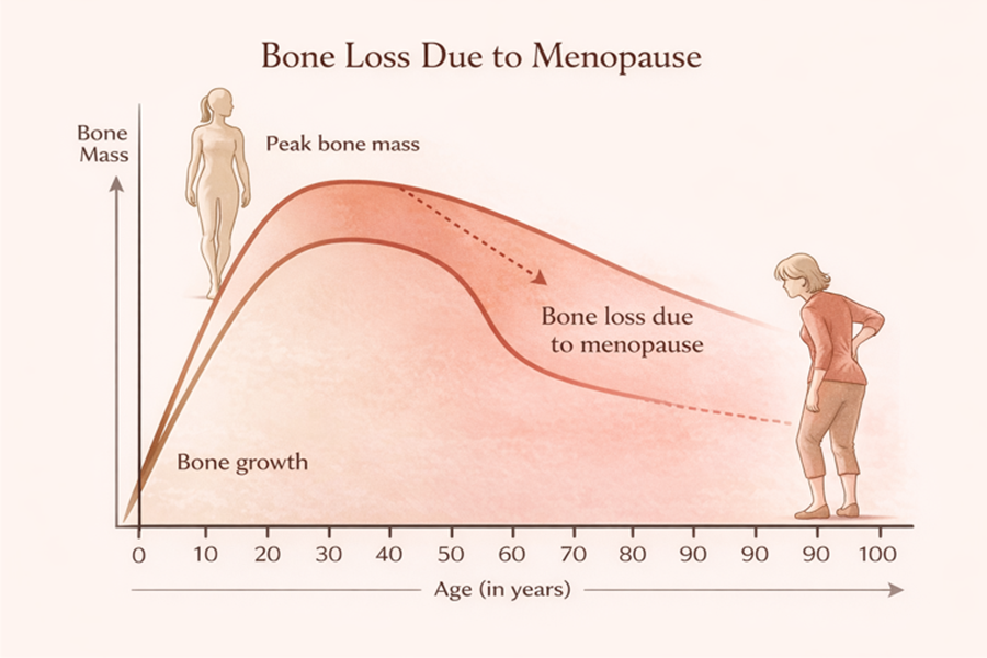 Bone Loss